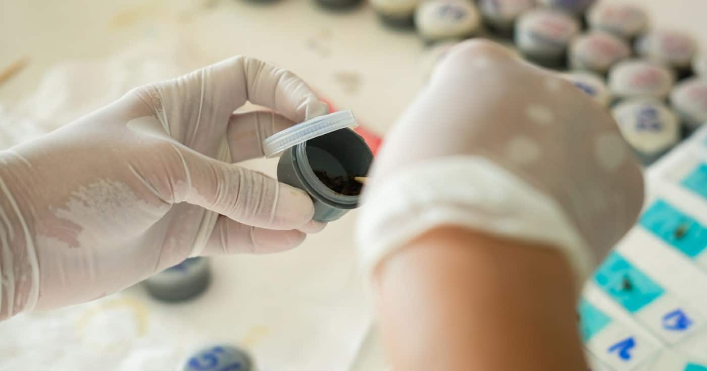 xét nghiệm chẩn đoán ung thư đại tràng