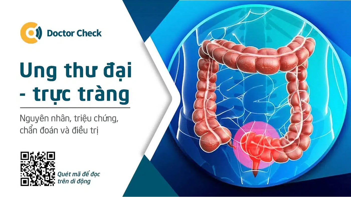 Ung thư đại - trực tràng: Nguyên nhân, dấu hiệu và phương pháp điều trị